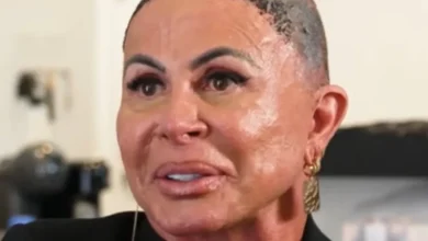 Gretchen fala sobre alopecia e revela detalhes de seu tratamento