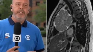 Médicos tomam decisão importante após diagnóstico de tumor em Alex Escobar