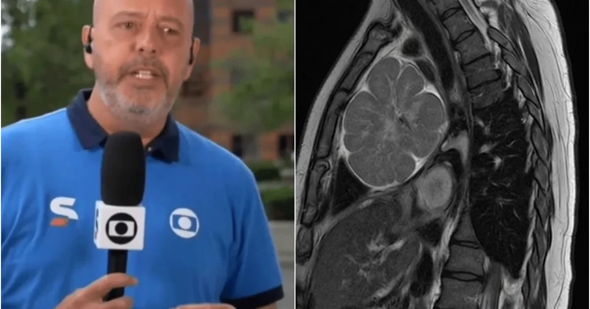 Médicos tomam decisão importante após diagnóstico de tumor em Alex Escobar