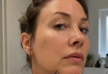 Por que algumas mulheres têm pelos no queixo?