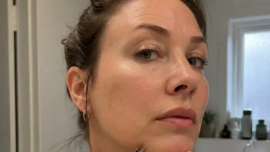 Por que algumas mulheres têm pelos no queixo?