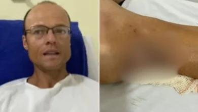Quatro pessoas são condenadas a indenizar triatleta após ataque de pitbulls