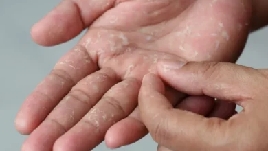 Se você estiver com esses sintomas, procure um médico