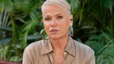 Xuxa descobre que o médico que realizou a cirurgia do seu nariz está preso