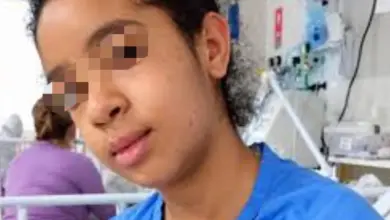 Ataque de abelhas: menina se manifesta do hospital