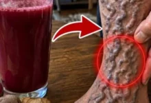Bebida que “restaura a circulação das pernas em 36 horas”? Entenda o que realmente se sabe