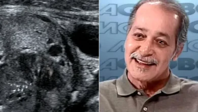 Causa revelada: Detalhes sobre a morte do ator Gracindo Jr., aos 83 anos, vêm à tona