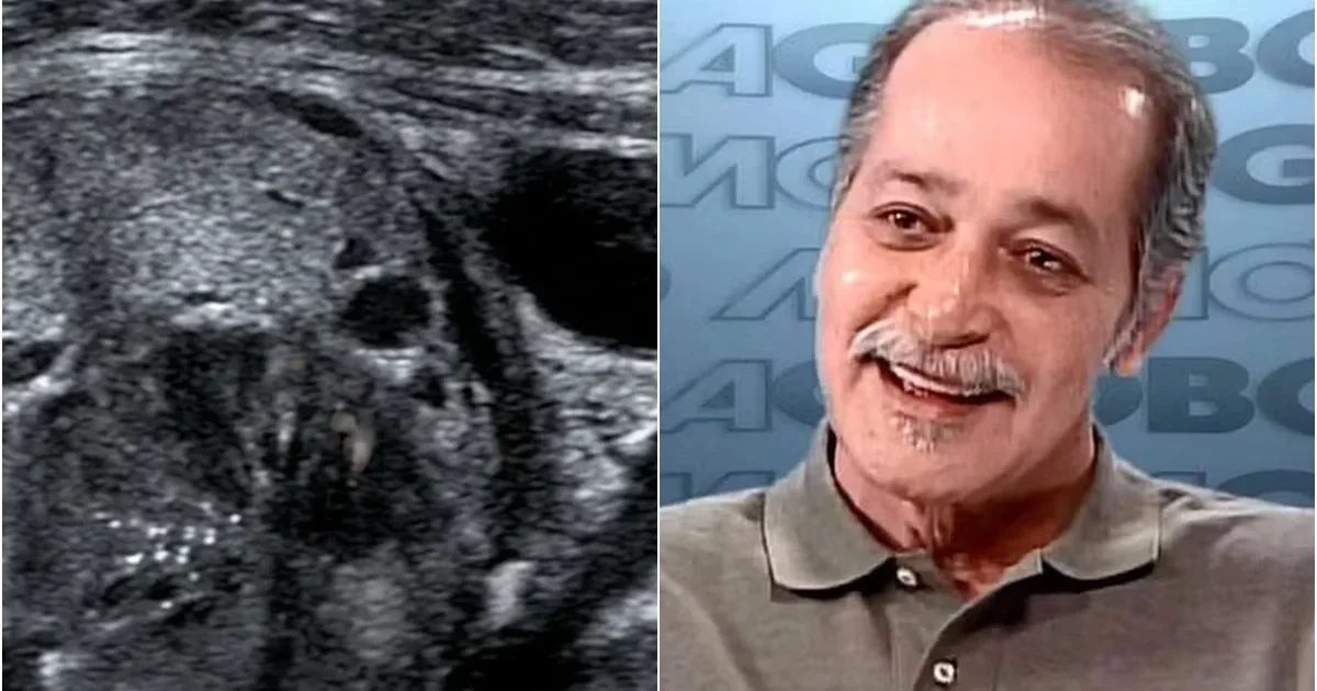Causa revelada: Detalhes sobre a morte do ator Gracindo Jr., aos 83 anos, vêm à tona