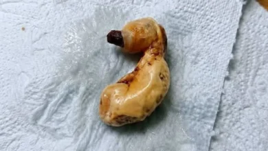 Ela encontrou um objeto estranho debaixo da cama do filho e descobriu como o medo pode enganar o cérebro