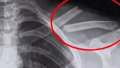 Esta bebida pode enfraquecer os ossos? O que a ciência realmente diz sobre o alerta que circula na internet