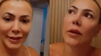 Ex-BBB Kelly Medeiros é diagnosticada com cisto no cérebro
