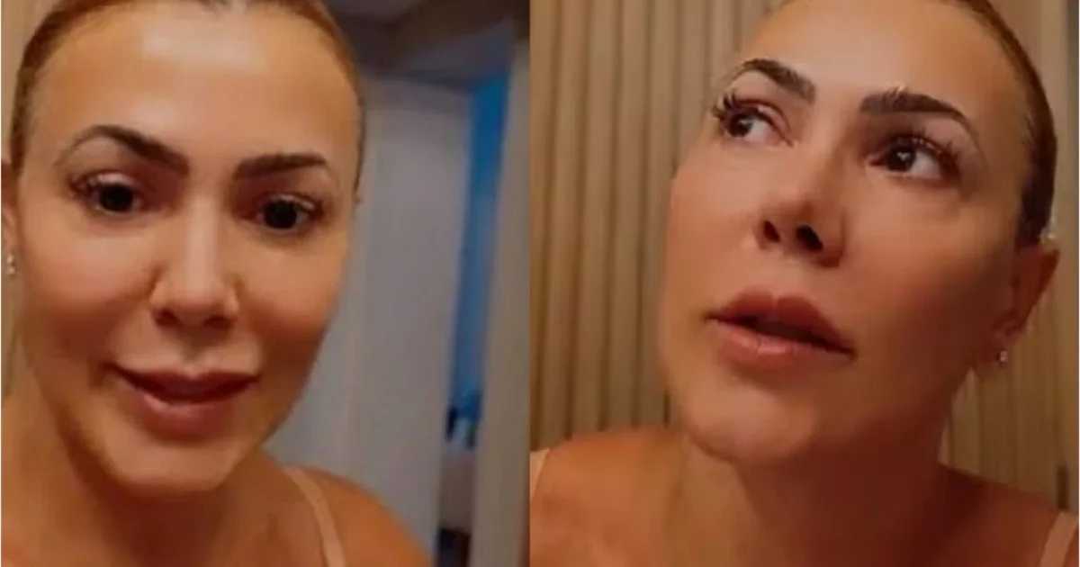 Ex-BBB Kelly Medeiros é diagnosticada com cisto no cérebro