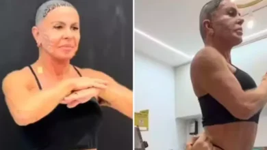 Gretchen mostra novo visual após procedimentos estéticos e transplante capilar