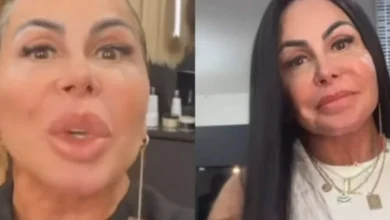 Gretchen surpreende ao mostrar tratamento