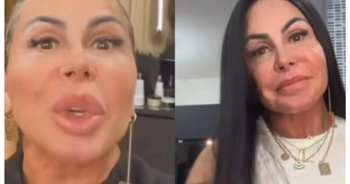 Gretchen surpreende ao mostrar tratamento
