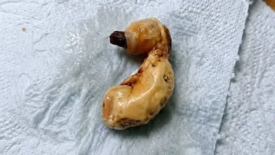 O que é isso? Objeto encontrado debaixo da cama chama atenção pela aparência incomum
