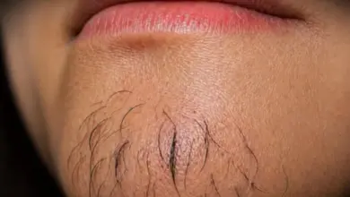 Pelo no queixo em mulheres: o que pode estar por trás desse sinal?