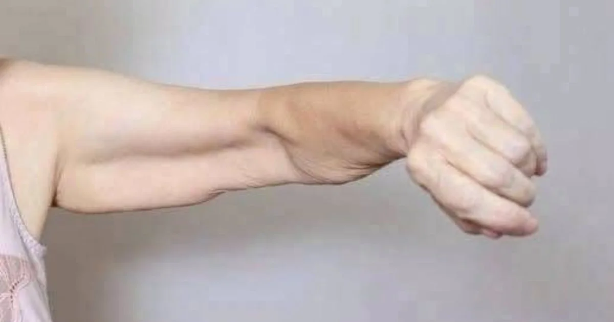 Sarcopenia: por que a perda de força pode começar aos poucos e como preservar os músculos