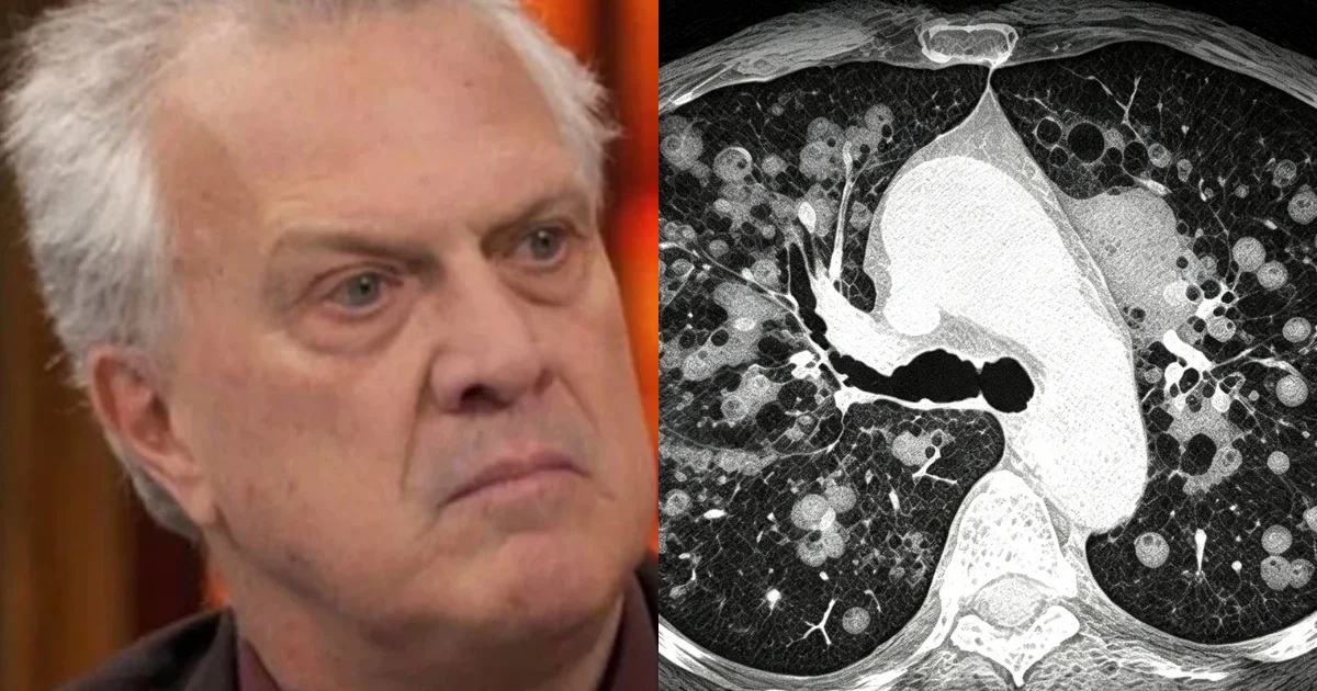 Aos 68 anos, Pedro Bial revela diagnóstico de enfisema pulmonar e desabafa sobre o cigarro