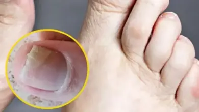 Dois sinais de alerta nos pés que merecem atenção: o que as unhas podem revelar sobre sua saúde