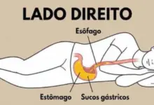 Dormir do lado direito pode piorar o refluxo? Entenda o que acontece com o estômago durante o sono