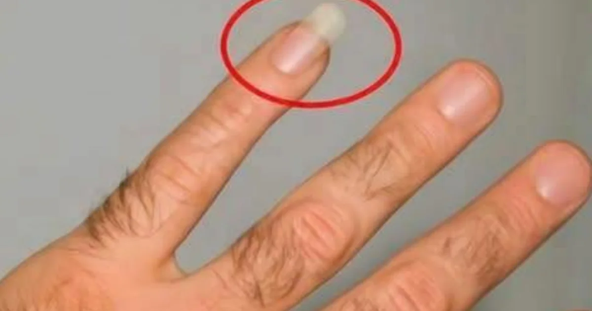 Por que algumas pessoas deixam a unha do dedo mindinho crescer tanto?