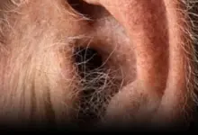 Sabia disso? Se os pelos crescem nas suas orelhas, isso pode ter uma explicação bem simples